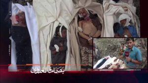 28 يوليو خلال 9 أعوام.. عنقوديات العدوان تفتك بالطفولة في اليمن