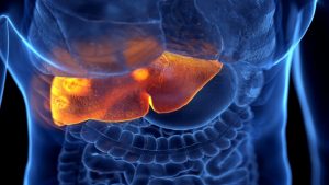 كيف تعرف أنك مصاب بـ”التهاب الكبد”؟