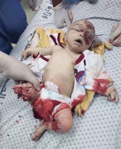 3 مجازر عنيفة للعدو الصهيوني ضد العائلات في غزة