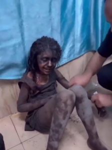 183شهيد وجريح في ثلاث مجازر للعدو الصهيوني