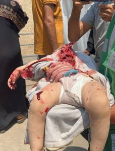 مئات الشهداء والجرحى بقطاع غزة إثر 5 مجازر مهولة للعدو