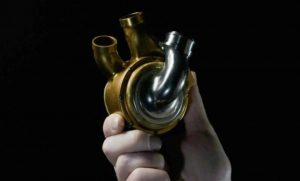 لأول مرة في العالم.. نجاح زراعة قلب يعمل بالتيتانيوم