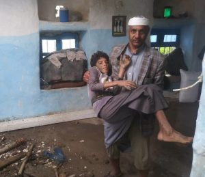 b5705ad3635a6a1fd2 وفاة شخصين وإصابة 4 آخرين بصواعق وتهدم منازل بسبب الأمطار بحجة