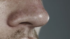 نخر الأنف قد تساهم في خطر الإصابة بمرض ألزهايمر