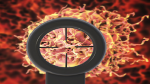 اكتشاف المسؤول عن تطور سرطان البروستات