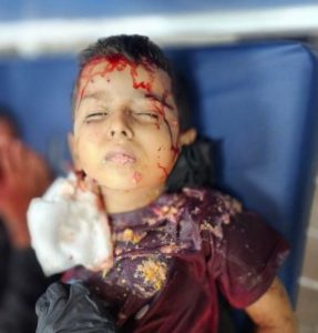 3d5f0fca4b7dfbfe8dc45293446f70c7 استشهاد اربعة فلسطينيين بقصف العدو مدرسة تؤوي نازحين شمال غزة