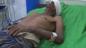 جريمة لمرتزقة العدوان بحق مواطنين في تعز