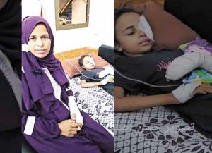 عربي سدين.. ضحية صاروخ صهيوني أفقدها نصف بصرها وأحرق جسدها