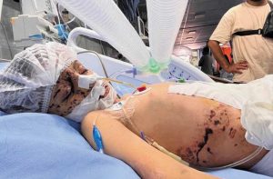 178 شهيداً وجريحاً في ثلاث مجازر صهيونية جديدة على غزة