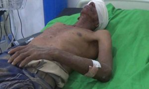 c62adc83575cd14556e8117ef57a5d44_medium تعز.. استشهاد مواطن وإصابة اثنين آخرين بقصف مرتزقة العدوان منطقة شوكان بماوية