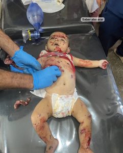 وسم (#غزة_تذبح_بصمت) صوت التضامن العالمي المناصر لغزة