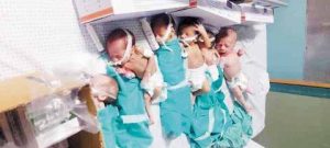 49 الأونروا تحذر من مجاعة تهدد حياة 15 ألف امرأة حامل في غزة