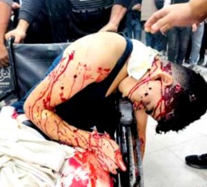   249 شهيداً وجريحاً في 5 مجازر جديدة للعدو بغزة وإحراق النازحين أحياء في المواصي