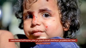 بالصور | جريمة قصف العدوان الأمريكي حي سكني بمديرية الثورة بالعاصمة صنعاء