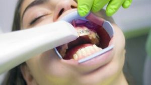 أداة مبتكرة لتشخيص صحة الأسنان باستخدام الذكاء الاصطناعي