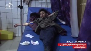 36 شهيداً وجريحاً حصيلة جديدة للجريمة الأمريكية غرب صنعاء