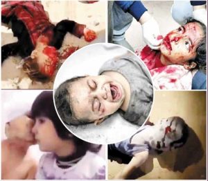 مشاهد تعكس الألم.. أطفال غزة يُذبحون أمام العالم دون أن يحرك ساكناً