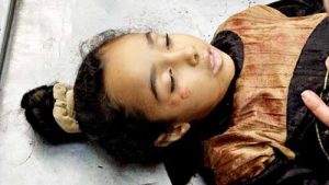 img79 حصيلة العدوان من الشهداء تتجاوز 51 ألفاً والآلاف تحت الأنقاض