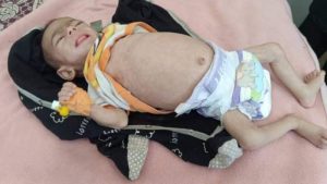 بالصورة.. استشهاد رضيعة فلسطينية بسبب المجاعة وعدم توفر الحليب