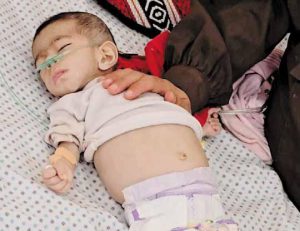 img228 استغاثة عالمية لإنقاذ حياة 2.4 مليون فلسطيني
