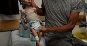 صحة غزة : ارتفاع ضحايا المجاعة إلى 154 شهيدا منهم 89 طفلا