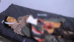 السلطة المحلية في تعز تُدين جريمة مرتزقة حزب الإصلاح في الهشمة
