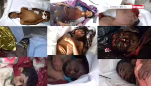 مواطنون ومهاجر أفريقي ضحايا قصف سعودي متعمد