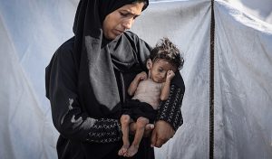 20250810015436 “صحة غزة”: حالتي وفاة نتيجة سوء التغذية في القطاع خلال الـ24 ساعة الماضية