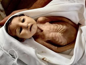 IMG_20250822_143859_483 وفاة رضيعة يرفع شهداء سوء التغذية بغزة إلى 272 حالة