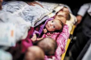 img245 في غزة المُجوَّعة.. حوامل يواجهن المخاطر وَأجِنّةٌ محاصَرون في الأرحام