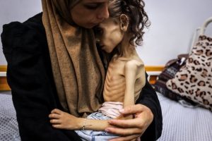 miVkBmCcGN1w4ksCpbQVluO9YcEx5tOc “الصحة بغزة”: 5 وفيات بينهم طفلان نتيجة المجاعة وسوء التغذية خلال الـ24 ساعة الماضية