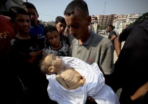 ارتفاع وفيات سوء التغذية بقطاع غزة إلى 382 شهيدًا