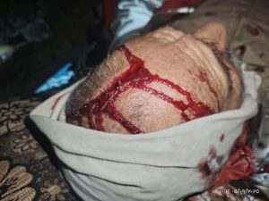 مستوطنون يعتدون بالضرب على ثلاثة فلسطينيين في مسافر يطا