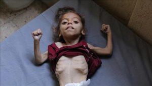 المجاعة بغزة الصحة بغزة :تسجيل خمس وفيات خلال الـ24 ساعة الماضية