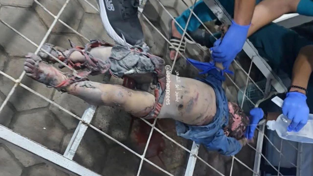 استشهاد وجرح أكثر من 100 فلسطيني بنيران العدو الإسرائيلي في مناطق متفرقة من قطاع غزة