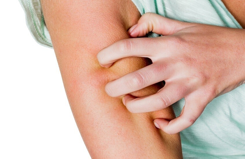 دراسة طبية: حكة الجلد قد تكون علامة خفية لأمراض الكبد والكلى